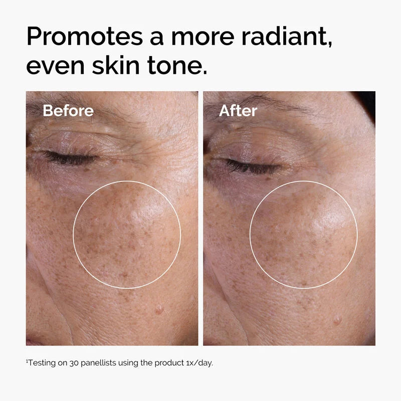 The Ordinary Glycolicb Acid 7% Exfoliating Toner
